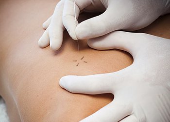 Focus Clinic Fisioterapia en El Cañaveral — foto 4